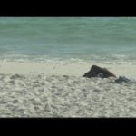 A trip to the beach turns deadly after she contracts flesh-eating bacteria – 10News WTSP