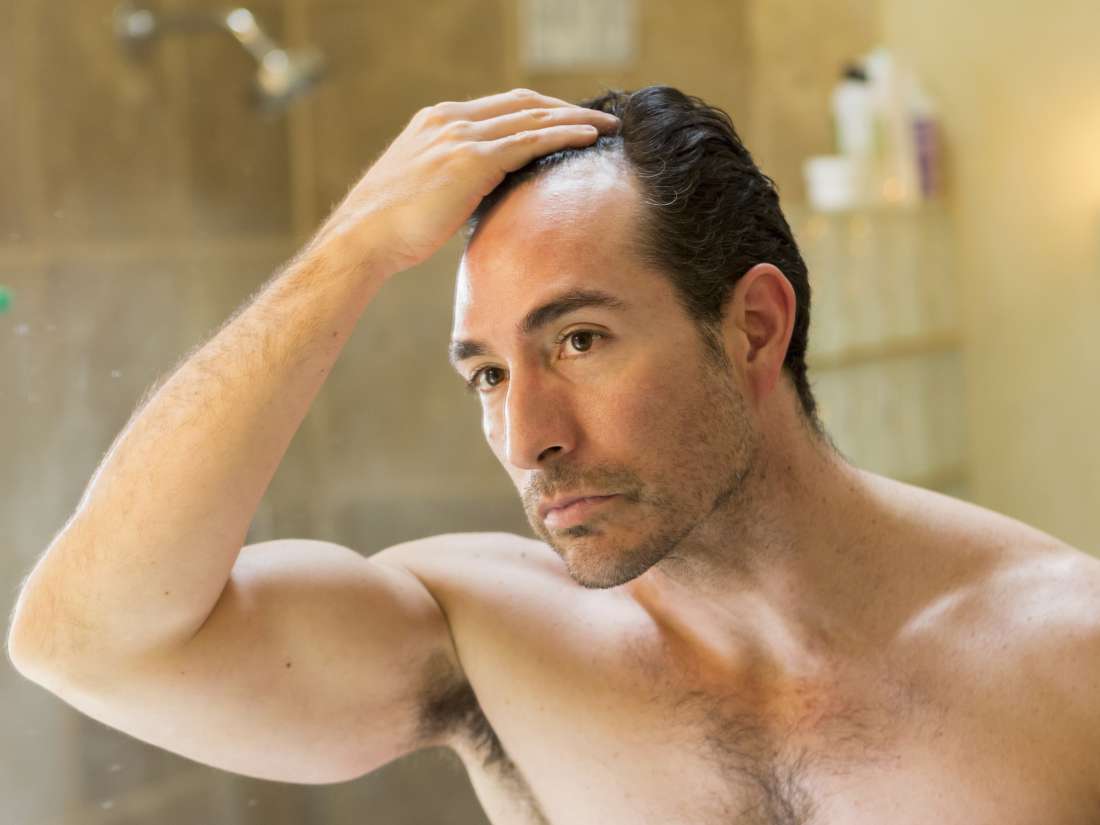 How 3D printing allows scientists to grow new human hairs – Medical News Today