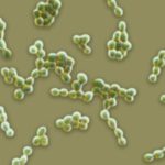 Florida woman dies of flesh-eating bacteria after a fall on Gulf Coast beach – Boston 25 News