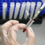 La hepatitis C, en la «frontera de la erradicación» entre personas con VIH – leonoticias.com