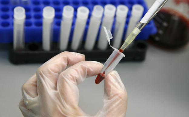 La hepatitis C, en la «frontera de la erradicación» entre personas con VIH – leonoticias.com