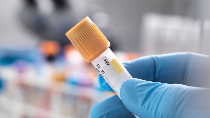 HIV diagnoses in Australia hit 18-year low, but there is still a way go – ABC News