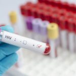 ¡Fuera de peligro! Desarrollaron medicamento que elimina definitivamente el VIH – Pulzo.com