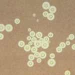 fungus which apparently metabolizes ionizing radiation