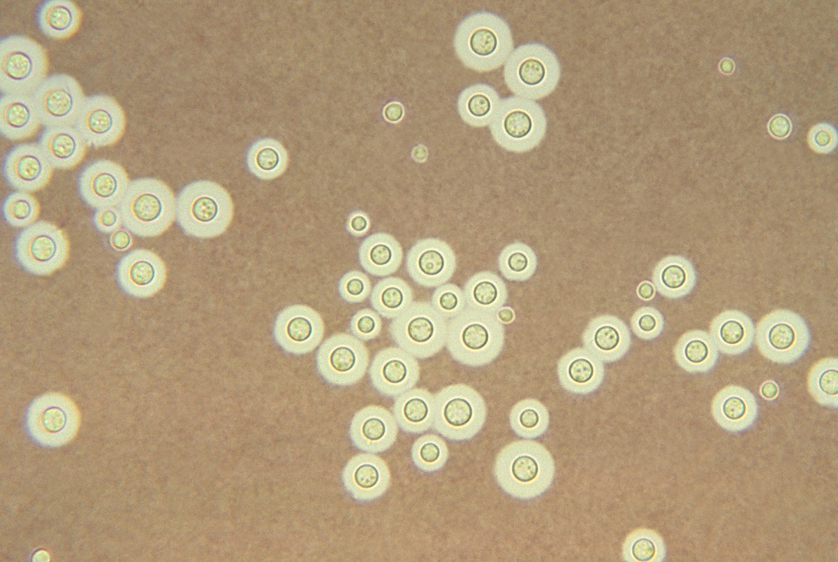 fungus which apparently metabolizes ionizing radiation