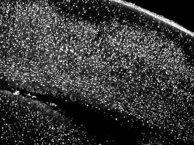In new study, researchers controlled behavior in a mouse’s brain with single-cell precision – Medical Xpress