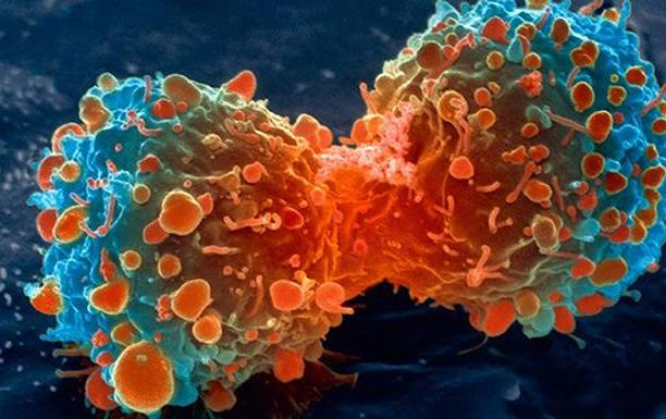 Científicos encuentran nuevo “talón de Aquiles” de cáncer – Panorama.com.ve
