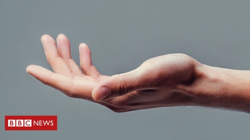 ‘Rewiring nerves’ reverses hand and arm paralysis – BBC News
