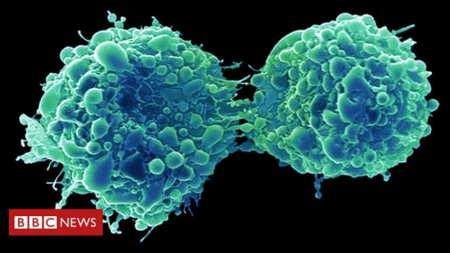 Bladder cancer ‘attacked and killed by common cold virus’ – BBC News