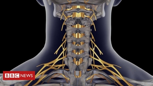 Surgeons in Australia have reversed hand and arm paralysis – BBC News