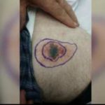 ‘My leg was on fire’: Ohio man warning others after getting bit by brown recluse spider – WJW FOX 8 News Cleveland