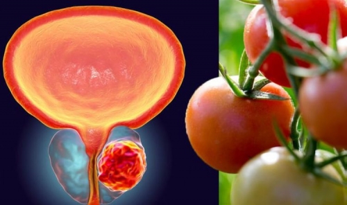 Prostate cancer: This popular food may lower the risk – do you include this in your diet? – Express