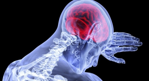 Women with a disabling neurological disorder are at twice the risk of heart conditions – Medical Xpress