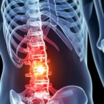 An ‘EpiPen’ for spinal cord injuries – University of Michigan News