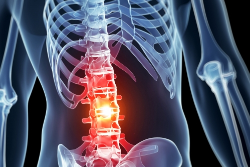 An ‘EpiPen’ for spinal cord injuries – University of Michigan News