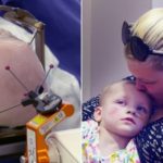 Two-year-old girl becomes the youngest patient EVER to receive deep brain stimulation therapy – Daily Mail