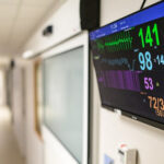 AI may spot deadly heart risk in a routine ECG