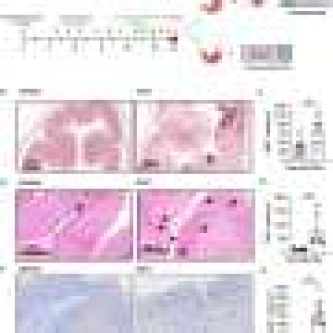 Researchers reveal immune mechanisms that drive development of rare allergic stomach disease