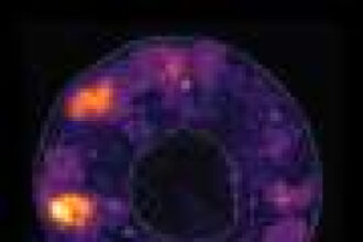 Regenerating tissues may rebuild order by amplifying tiny cell differences