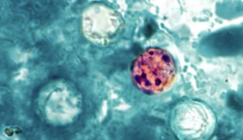 Infections from Cyclospora parasite continue sharp increases