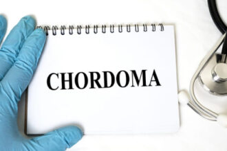 Chordoma Guidance Moves Into Age of Shared Decision-Making