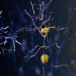 Brain Aging Advances More Quickly for People With Metabolic Syndrome