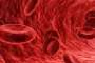 Have the clinical signs of a serious type of blood cancer changed?