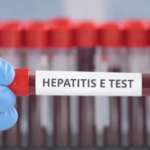 Limited hepatitis E knowledge in pig sector hinders assessment approach