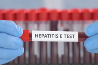 Limited hepatitis E knowledge in pig sector hinders assessment approach