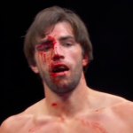 Love Island winner suffers gnarly cut as he’s stopped within a round in BKB Bare Knuckle Boxing