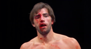 Love Island winner suffers gnarly cut as he’s stopped within a round in BKB Bare Knuckle Boxing
