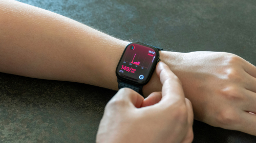5 Cheaper Apple Watch Alternatives You Can Buy On Amazon