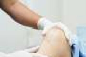 Crohn disease linked to increased risk for periprosthetic joint infection