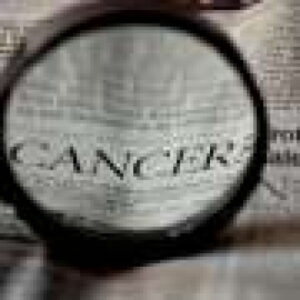 AI analysis could help tailor intensified treatment for locally advanced rectal cancer