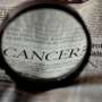 AI analysis could help tailor intensified treatment for locally advanced rectal cancer