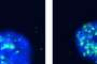 Study finds new weak spot linked to DNA repair in aggressive, drug-resistant cancers