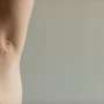 Povorcitinib beneficial for moderate-to-severe hidradenitis suppurativa