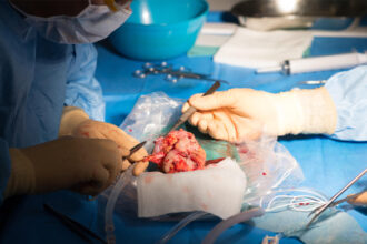 COVID Study Supports Antiviral Use in Kidney Transplant Recipients
