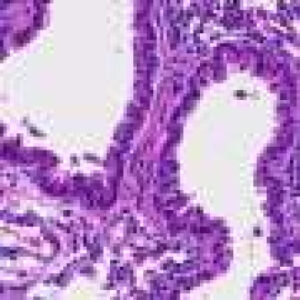 This amino acid may help the body fight tumors and viral infections