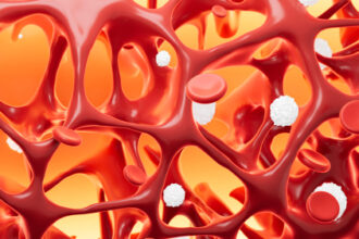 Bone Density Appears to Rebound in Transgender Youth After Puberty Blockers Are Done