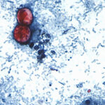 Michigan Reports First Two U.S. Deaths Related to Diarrhea-Causing Parasite