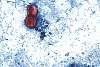 Michigan Reports First Two U.S. Deaths Related to Diarrhea-Causing Parasite