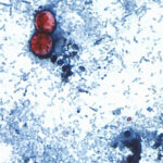 Michigan reports first 2 US deaths in cyclospora outbreak