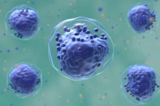 Liposomal Chemo Combination No Better Than Standard Induction in Pediatric AML