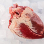Donor Hearts May Work Better if Stored Slightly Warmer