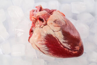 Donor Hearts May Work Better if Stored Slightly Warmer