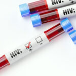 HIV Care Disengagement Common in Missouri