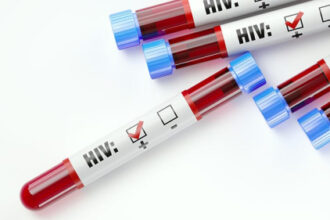 HIV Care Disengagement Common in Missouri