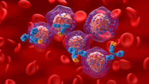 Despite Progress in TNBC, More Biomarkers Are Needed to Improve Outcomes