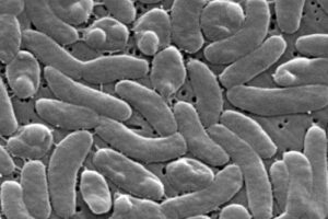 Health officials urge caution for Gulf Coast beachgoers during surge of deadly bacterial infections…